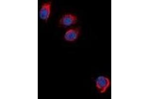 Immunofluorescent analysis of EPO Receptor staining in NIH3T3 cells. (EPOR antibody)