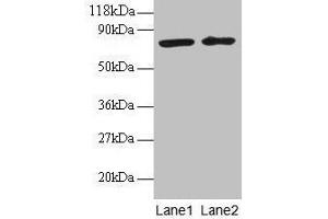 Western blot All lanes: BLOC1S1 antibody at 2 μg/mL Lane 1: EC109 whole cell lysate Lane 2: 293T whole cell lysate Secondary Goat polyclonal to rabbit IgG at 1/15000 dilution Predicted band size: 18, 15 kDa Observed band size: 75 kDa