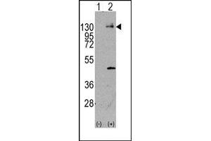 Image no. 1 for anti-Platelet Derived Growth Factor Receptor alpha (PDGFRA) (Tyr720) antibody (ABIN359908) (PDGFRA antibody  (Tyr720))