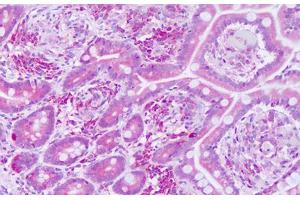 Image no. 2 for anti-KTI12 Homolog, Chromatin Associated (KTI12) (AA 170-219) antibody (ABIN6749797) (KTI12 antibody  (AA 170-219))