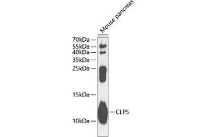 Western blot analysis of extracts of mouse pancreas, using CLPS antibody  at 1:1000 dilution. (CLPS antibody  (AA 18-112))