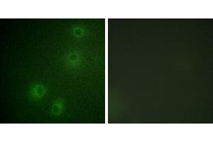 P-peptide - +Immunofluorescence analysis of COS-7 cells, using Integrin β1 (Phospho-Tyr789) antibody. (ITGB1 antibody  (pThr789))