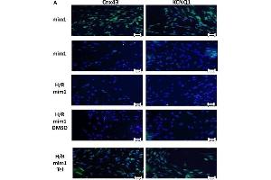 Telmisartan effects on hypoxic H9c2 cardiomyocytes transfected with miR-1 mimic. (KCNQ1 antibody  (AA 501-600))