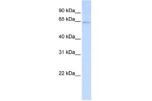 WB Suggested Anti-LRFN3 Antibody Titration:  0. (LRFN3 antibody  (C-Term))