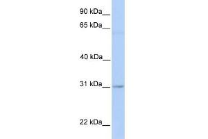 WB Suggested Anti-MARCH2 Antibody Titration:  0. (MARCH2 antibody  (Middle Region))