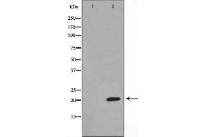 Western blot analysis on Jurkat cell lysate using Musculin Antibody,The lane on the left is treated with the antigen-specific peptide.