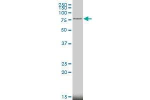 MECP2 monoclonal antibody (M01), clone 4B6 Western Blot analysis of MECP2 expression in MCF-7 . (MECP2 antibody  (AA 81-170))