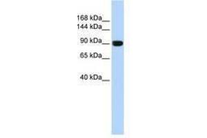 Image no. 1 for anti-Anoctamin 1, Calcium Activated Chloride Channel (ANO1) (AA 828-877) antibody (ABIN6740769) (ANO1 antibody  (AA 828-877))