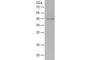 Western Blotting (WB) image for Phosphate Cytidylyltransferase 1, Choline, beta (PCYT1B) (AA 14-181) protein (His-IF2DI Tag) (ABIN7124396) (PCYT1B Protein (AA 14-181) (His-IF2DI Tag))