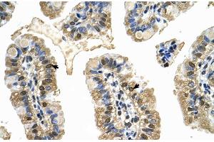 Human Intestine (MCM8 antibody  (C-Term))