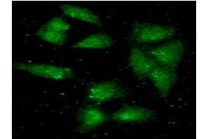 ICC/IF analysis of ALDH2 in A549 cells line, stained with monoclonal anti-human ALDH2 antibody (1:100) with goat anti-mouse IgG-Alexa fluor 488 conjugate (Green). (ALDH1A1 antibody  (AA 18-517))