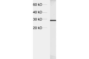 dilution: 1 : 5000, sample: crude synaptosomal fraction of rat brain (P2) (Synaptogyrin 1 antibody  (AA 220-234))