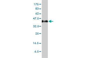 SERPINH1 monoclonal antibody (M01), clone S2 Western Blot analysis of SERPINH1 expression in HeLa . (SERPINH1 antibody  (AA 1-418))