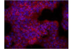 Immunofluorescence (IF) image for anti-Receptor tyrosine-protein kinase erbB-2 (ErbB2/Her2) antibody (ABIN2664604) (ErbB2/Her2 antibody)