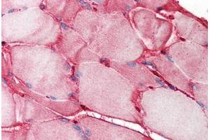 Human Skeletal Muscle (formalin-fixed, paraffin-embedded) stained with FN1 antibody ABIN214358 at 1. (Fibronectin 1 antibody)