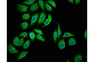 Immunofluorescence staining of A549 cells with ABIN7158336 at 1:100, counter-stained with DAPI. (LMCD1 antibody  (AA 105-268))