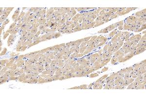 Detection of cTnI in Human Cardiac Muscle Tissue using Polyclonal Antibody to Cardiac Troponin I (cTnI) (TNNI3 antibody  (AA 1-203))