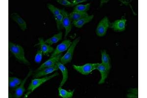 Immunofluorescent analysis of Hela cells using ABIN7144661 at dilution of 1:100 and Alexa Fluor 488-congugated AffiniPure Goat Anti-Rabbit IgG(H+L)