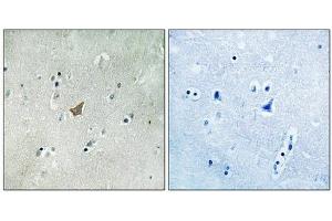 Immunohistochemical analysis of paraffin-embedded human brain tissue using EPHA3/4/5 (Phospho-Tyr779/833) antibody (left)or the same antibody preincubated with blocking peptide (right). (EPH Receptor A3 antibody  (pTyr779, pTyr833))