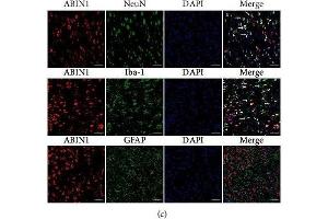 TNIP1 antibody