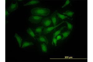Immunofluorescence of monoclonal antibody to PBK on HeLa cell. (PBK antibody  (AA 1-110))