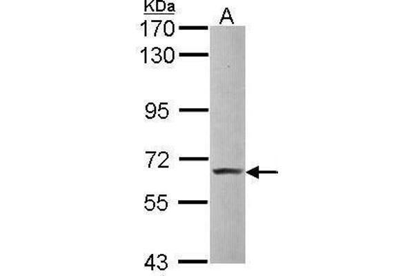 ZBTB7A Antikörper  (C-Term)