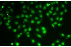 Immunofluorescence analysis of A-549 cells using HDAC5 Polyclonal Antibody (HDAC5 antibody)