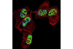Fluorescent confocal image of MDA-M cell stained with ZN Antibody (Center) (ABIN653731 and ABIN2843038). (ZNF202 antibody  (AA 342-370))