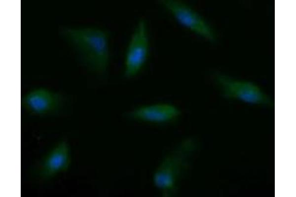MSI2 antibody