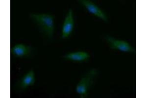 Image no. 8 for anti-Musashi Homolog 2 (MSI2) antibody (ABIN1499578) (MSI2 antibody)