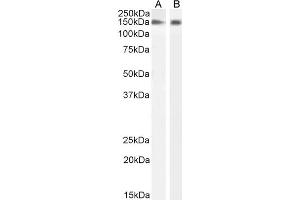 ABIN184662 (2µg/ml) staining of Human Frontal Cortex (A) and (1ug/ml) Brain Sub Ventricular Zone (B) lysate (35µg protein in RIPA buffer). (NOS1 antibody  (C-Term))