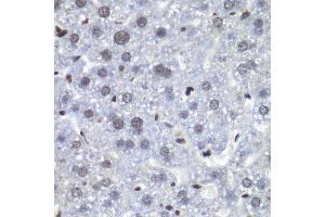 Immunohistochemistry (Paraffin-embedded Sections) (IHC (p)) image for anti-Retinoblastoma Binding Protein 5 (RBBP5) (AA 319-538) antibody (ABIN6146741)