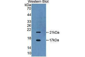 Figure. (CBY1/PGEA1 antibody  (AA 7-127))