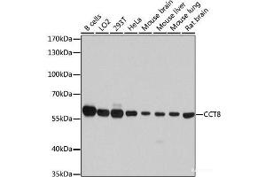 Western blot analysis of extracts of various cell lines using CCT8 Polyclonal Antibody at dilution of 1:7000.