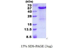 Image no. 1 for KIN, Antigenic Determinant of RecA Protein Homolog (KIN) protein (His tag) (ABIN1098450) (KIN Protein (His tag))