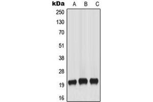 Western blot analysis of MART-1 expression in HeLa (A), A431 (B), WERI (C) whole cell lysates.