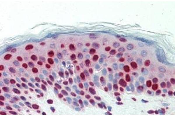 DCLRE1C antibody  (AA 21-50)