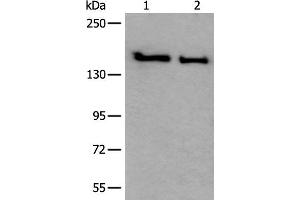 Western blot analysis of HUVEC and Jurkat cell lysates using SMC1A Polyclonal Antibody at dilution of 1:300 (SMC1A antibody)