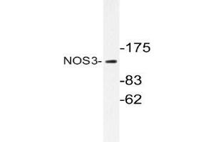 Western blot (WB) analyzes of NOS3 antibody in extracts from Jurkat cells. (ENOS antibody)