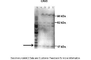 Lanes:   Lane1: 50 ug human placental tissue lysate Lane2: 40 ug human placental tissue lysate Lane3: 30 ug human placental tissue lysate Lane4: 20 ug human placental tissue lysate Lane5: 20 ug human myometrial tissue lysate  Primary Antibody Dilution:   1:500  Secondary Antibody:   Goat anti-rabbit HRP  Secondary Antibody Dilution:   1:10000  Gene Name:   Caveolin 3  Submitted by:   Hiten Mistry, Ania Czajka and Marta Hentschke Ribeiro, King's College London (Caveolin 3 antibody  (N-Term))