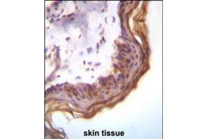 Kallikrein 7(KLK7) Antibody immunohistochemistry analysis in formalin fixed and paraffin embedded human skin tissue followed by peroxidase conjugation of the secondary antibody and DAB staining. (Kallikrein 7 antibody  (AA 67-97))