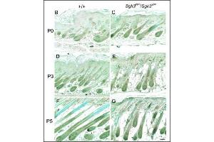 IHCdetection of SGK3 protein on the paraffin sections of the WT (left) and YPC (right) mice at P0 (B and C), P3 (D and E), and P5 (F and G) skin. (SGK3 antibody  (N-Term))