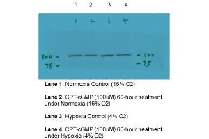 Western Blotting (WB) image for anti-Transient Receptor Potential Cation Channel, Subfamily C, Member 6 (TRPC6) (Middle Region) antibody (ABIN2776163)