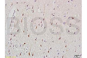 Formalin-fixed and paraffin embedded: rat brain tissue labeled with Anti-CK2 Polyclonal Antibody (ABIN730813), Unconjugated at 1:200, followed by conjugation to the secondary antibody and DAB staining (Keratin 2 antibody  (AA 535-638))