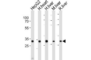 Western blot analysis of lysates from HepG2 cell line, human heart, human liver, mouse liver, rat liver tissue lysate (from left to right), using DECR1 Antibody (Center) (ABIN6243564 and ABIN6577825). (DECR1 antibody  (AA 241-274))