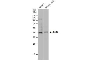 WB Image DAZL antibody detects DAZL protein by western blot analysis. (DAZL antibody  (C-Term))