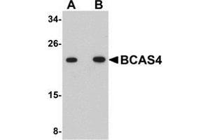 Western blot analysis of BCAS4 in 3T3 cell lysate with AP30127PU-N BCAS4 antibody at (A) 1 and (B) 2 μg/ml. (BCAS4 antibody  (N-Term))