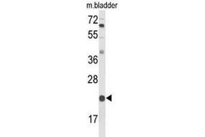 Western blot analysis of DGCR6 Antibody (Center) in mouse bladder tissue lysates (35µg/lane). (DGCR6 antibody  (Middle Region))