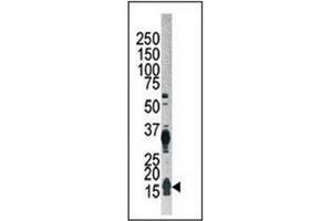 Western blot analysis of APG12L Antibody   in Hela cell lysate. (ATG12 antibody  (N-Term))