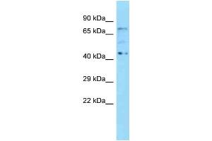WB Suggested Anti-Kbtbd5 Antibody Titration: 1.